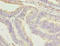 NOTCH Regulated Ankyrin Repeat Protein antibody, A63050-100, Epigentek, Immunohistochemistry paraffin image 