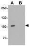 CycT1 antibody, GTX17200, GeneTex, Western Blot image 