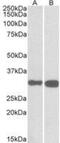 Pyridoxal phosphate phosphatase antibody, NBP2-27461, Novus Biologicals, Western Blot image 