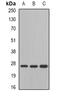 Glutathione S-transferase Mu 4 antibody, abx141542, Abbexa, Western Blot image 