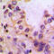 Cytochrome P450 Family 39 Subfamily A Member 1 antibody, GTX55952, GeneTex, Immunohistochemistry paraffin image 