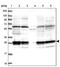 Proteasome 26S Subunit, Non-ATPase 9 antibody, PA5-59203, Invitrogen Antibodies, Western Blot image 