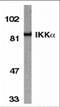 Inhibitor of nuclear factor kappa-B kinase subunit alpha antibody, 2025, ProSci Inc, Western Blot image 