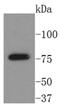 Bruton Tyrosine Kinase antibody, NBP2-67675, Novus Biologicals, Western Blot image 