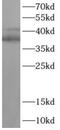 T-cell acute lymphocytic leukemia protein 1 antibody, FNab10041, FineTest, Western Blot image 