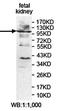 Phospholipase C Beta 2 antibody, orb78270, Biorbyt, Western Blot image 