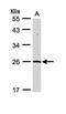 SUMO Peptidase Family Member, NEDD8 Specific antibody, GTX110478, GeneTex, Western Blot image 