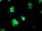 Regulatory Factor X Associated Ankyrin Containing Protein antibody, MA5-25859, Invitrogen Antibodies, Immunocytochemistry image 
