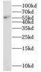 NMD3 Ribosome Export Adaptor antibody, FNab05760, FineTest, Western Blot image 