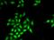 Histone-lysine N-methyltransferase SETMAR antibody, orb373465, Biorbyt, Immunocytochemistry image 