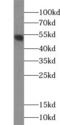 Tubulointerstitial Nephritis Antigen Like 1 antibody, FNab08711, FineTest, Western Blot image 
