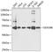 DExD-Box Helicase 39B antibody, 23-529, ProSci, Western Blot image 