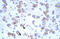 Cation Channel Sperm Associated 2 antibody, ARP35455_T100, Aviva Systems Biology, Immunohistochemistry paraffin image 