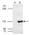 Squamous cell carcinoma antigen recognized by T-cells 3 antibody, GTX107684, GeneTex, Immunoprecipitation image 