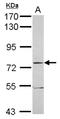 E3 ubiquitin-protein ligase TRIM56 antibody, NBP2-20722, Novus Biologicals, Western Blot image 