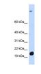 Chromosome 6 Open Reading Frame 201 antibody, NBP1-70476, Novus Biologicals, Western Blot image 