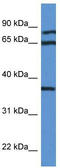 Deoxyhypusine synthase antibody, TA343131, Origene, Western Blot image 