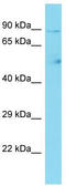 Coiled-Coil Domain Containing 142 antibody, TA333606, Origene, Western Blot image 