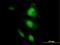 Heat Shock Protein Family A (Hsp70) Member 2 antibody, MA5-19150, Invitrogen Antibodies, Immunofluorescence image 