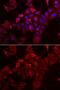 Myotilin antibody, GTX54355, GeneTex, Immunocytochemistry image 