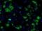 Fumarylacetoacetate Hydrolase Domain Containing 2A antibody, GTX84538, GeneTex, Immunofluorescence image 