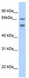 RBM35B antibody, TA329614, Origene, Western Blot image 