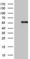 Alpha-N-acetylgalactosaminidase antibody, CF811320, Origene, Western Blot image 