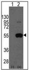 Aldehyde Dehydrogenase 2 Family Member antibody, AP22751PU-N, Origene, Western Blot image 
