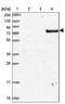 Armadillo Like Helical Domain Containing 3 antibody, PA5-62264, Invitrogen Antibodies, Western Blot image 