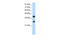 Poly(RC) Binding Protein 2 antibody, 29-344, ProSci, Enzyme Linked Immunosorbent Assay image 