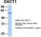 Succinyl-CoA:3-ketoacid-coenzyme A transferase 1, mitochondrial antibody, TA346672, Origene, Western Blot image 