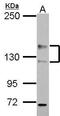 ADAM Metallopeptidase With Thrombospondin Type 1 Motif 18 antibody, GTX117039, GeneTex, Western Blot image 