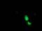 Alcohol Dehydrogenase 1B (Class I), Beta Polypeptide antibody, MA5-25525, Invitrogen Antibodies, Immunocytochemistry image 