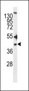 Zinc Finger DHHC-Type Containing 20 antibody, LS-C157401, Lifespan Biosciences, Western Blot image 