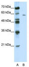 NACC Family Member 2 antibody, TA337279, Origene, Western Blot image 