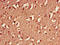 Tyrosine 3-Monooxygenase/Tryptophan 5-Monooxygenase Activation Protein Eta antibody, A53161-100, Epigentek, Immunohistochemistry paraffin image 