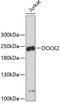 Dedicator Of Cytokinesis 2 antibody, 19-099, ProSci, Western Blot image 