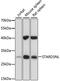 STARD3 N-Terminal Like antibody, A11121, Boster Biological Technology, Western Blot image 