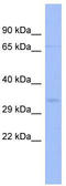 Zinc Finger Protein 80 antibody, TA339441, Origene, Western Blot image 