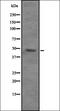 Vacuolar Protein Sorting 4 Homolog B antibody, orb335097, Biorbyt, Western Blot image 