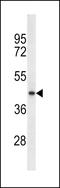 Trans-2,3-Enoyl-CoA Reductase Like antibody, LS-C157090, Lifespan Biosciences, Western Blot image 