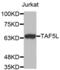 TATA-Box Binding Protein Associated Factor 5 Like antibody, abx002448, Abbexa, Western Blot image 