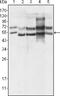 GA-binding protein alpha chain antibody, STJ98095, St John
