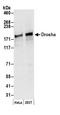 Drosha Ribonuclease III antibody, A301-886A, Bethyl Labs, Western Blot image 