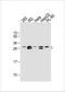 Eukaryotic Translation Initiation Factor 4E Family Member 2 antibody, GTX82524, GeneTex, Western Blot image 