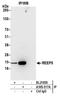 Protein TB2 antibody, A305-517A, Bethyl Labs, Immunoprecipitation image 