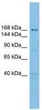 Ubiquitin Conjugating Enzyme E2 O antibody, TA344708, Origene, Western Blot image 