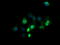 Zinc Finger And SCAN Domain Containing 21 antibody, TA506118, Origene, Immunofluorescence image 