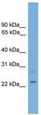 RNA Binding Motif Protein 11 antibody, TA343996, Origene, Western Blot image 