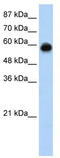 Kelch Like ECH Associated Protein 1 antibody, TA343695, Origene, Western Blot image 